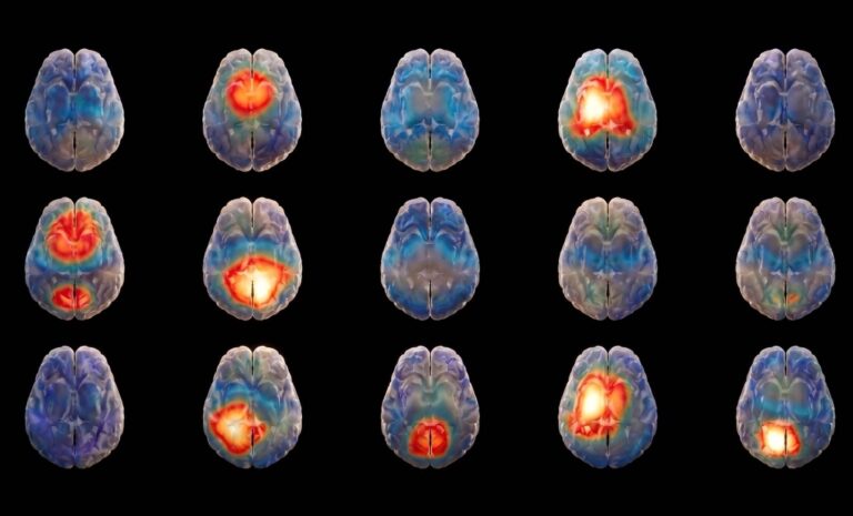 Israeli Startup Uses AI to Diagnose Brain Disorders in 15 Minutes