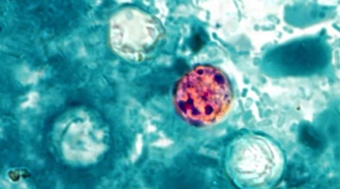 First Deaths from ‘Explosive Diarrhea’ Parasite Outbreak Reported